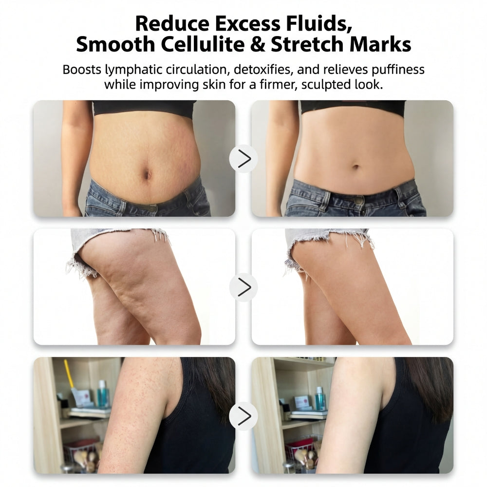 Thermo‑Pulse™ Massageapparat til cellulite og lymfedrænage