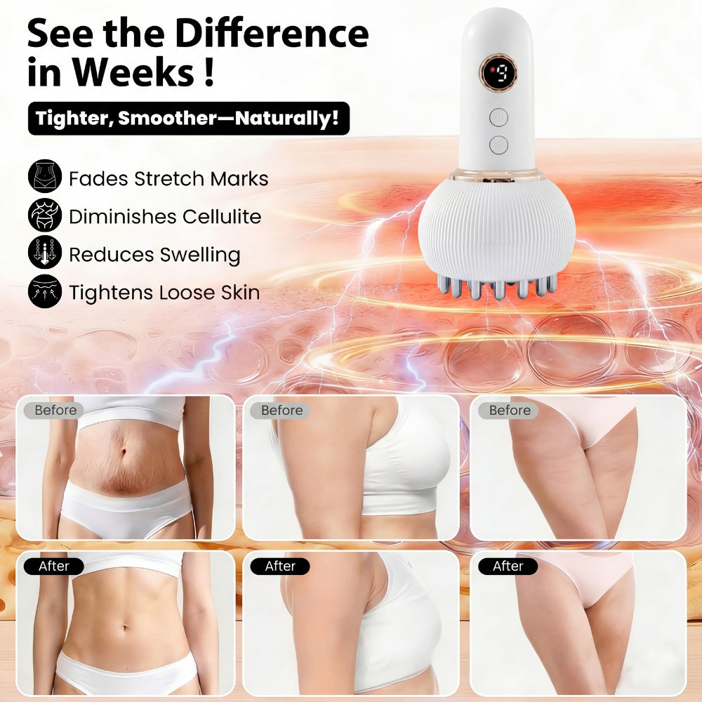 Thermo‑Pulse™ Massageapparat til cellulite og lymfedrænage
