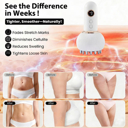 Thermo‑Pulse™ Massageapparat til cellulite og lymfedrænage