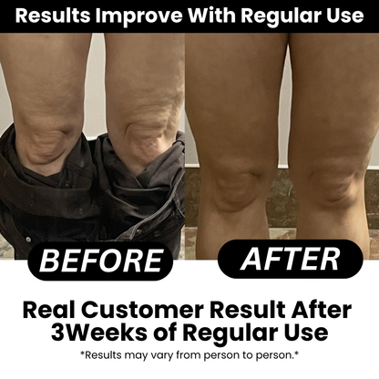 Anti-cellulite massageolie